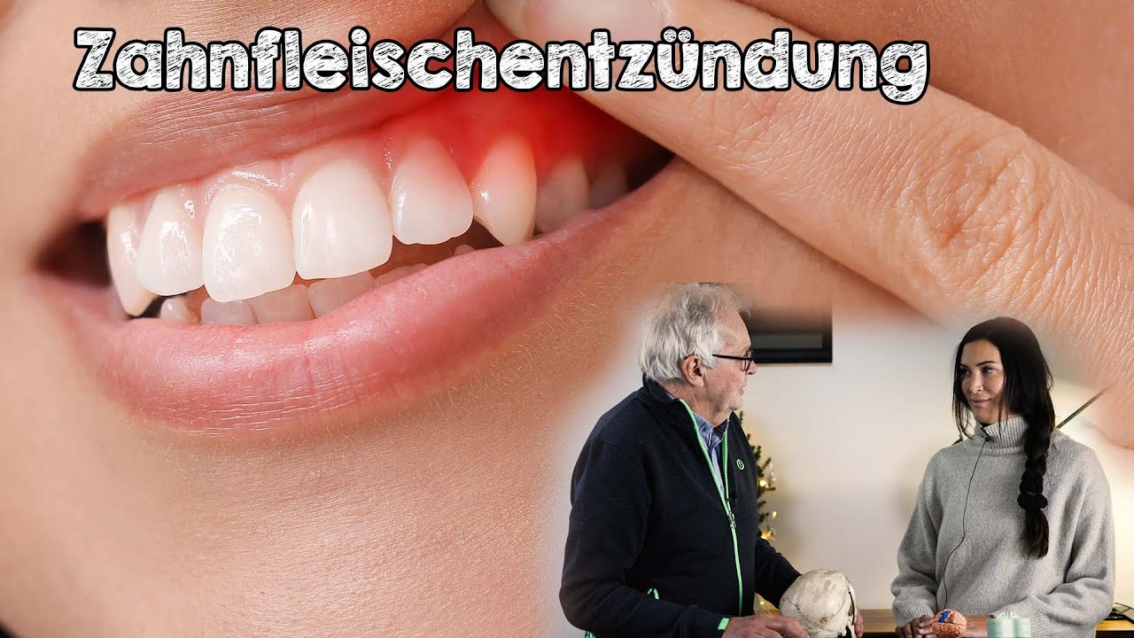 Richtig Vorbeugen Bei Zahnfleischentzündung, Parodontitis Und ...