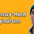 Gesichtslähmung - Ramsay-Hunt Syndrom bei Justin Bieber - Ursachen, Auswirkungen, Folgen verstehen